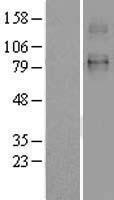 SLC26A2 Human Over-expression Lysate