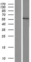 Cytochrome P450 17A1 (CYP17A1) Human Over-expression Lysate