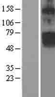 Chloride Channel 5 (CLCN5) Human Over-expression Lysate