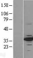 CDK4 Human Over-expression Lysate