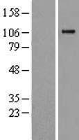 Complement Component 6 (C6) Human Over-expression Lysate