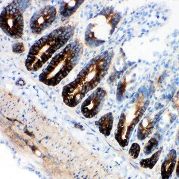 NKCC1/SLC12A2 Rabbit Polyclonal Antibody