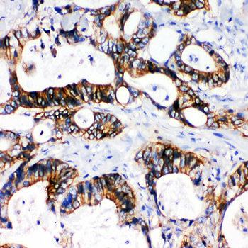 NKCC1/SLC12A2 Rabbit Polyclonal Antibody