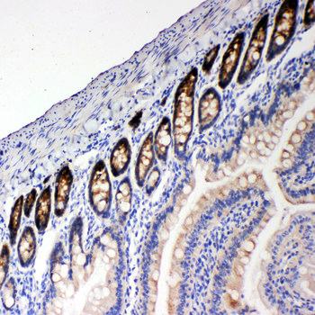 NKCC1/SLC12A2 Rabbit Polyclonal Antibody