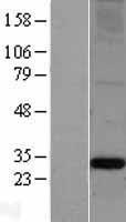 Apolipoprotein A I (APOA1) Human Over-expression Lysate
