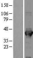 Aldolase (ALDOA) Human Over-expression Lysate