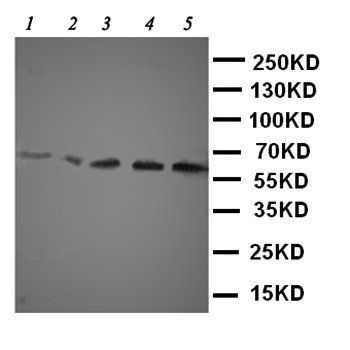 Solute carrier family 22 member 5/SLC22A5 Rabbit Polyclonal Antibody
