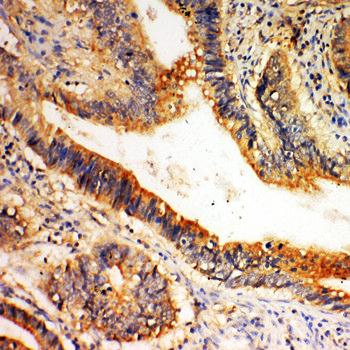 SLC1A4 Rabbit Polyclonal Antibody