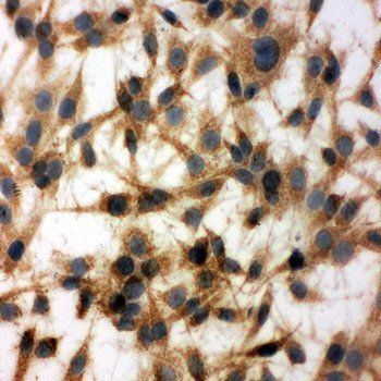 MTCO1/MT-CO1/MT Rabbit Polyclonal Antibody