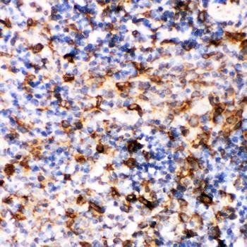 Caspase-6/CASP6 Rabbit Polyclonal Antibody