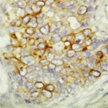 Caspase-6/CASP6 Rabbit Polyclonal Antibody