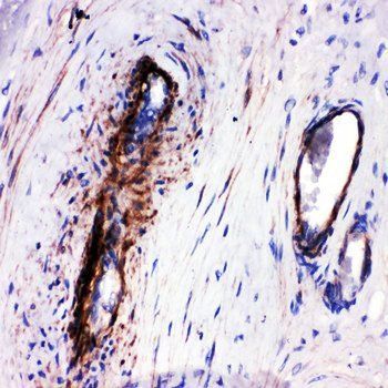 LIM and SH3 domain protein 1 LASP1 Rabbit Polyclonal Antibody