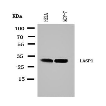 LIM and SH3 domain protein 1 LASP1 Rabbit Polyclonal Antibody