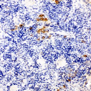 Leupaxin/LPXN Rabbit Polyclonal Antibody