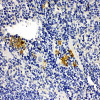 Leupaxin/LPXN Rabbit Polyclonal Antibody