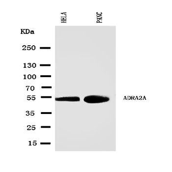 alpha 2a Adrenergic Receptor/ADRA2A Rabbit Polyclonal Antibody