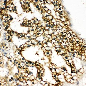 Catechol O-methyltransferase COMT Rabbit Polyclonal Antibody