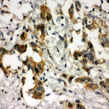 Catechol O-methyltransferase COMT Rabbit Polyclonal Antibody
