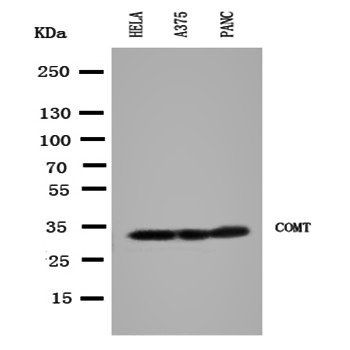 Catechol O-methyltransferase COMT Rabbit Polyclonal Antibody