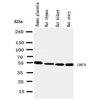 Interferon regulatory factor 5 IRF5 Rabbit Polyclonal Antibody