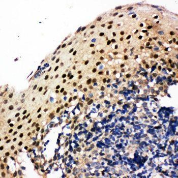 Krueppel-like factor 4 KLF4 Rabbit Polyclonal Antibody