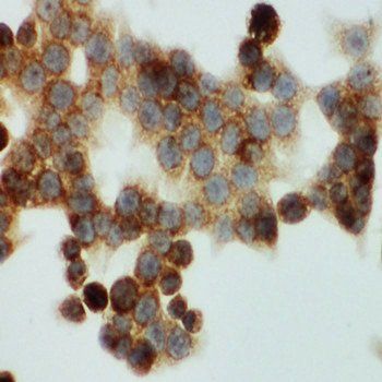 HNF6/ONECUT1 Rabbit Polyclonal Antibody
