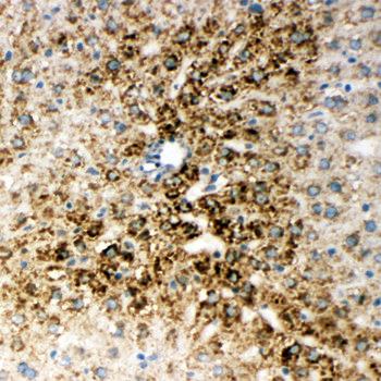 HNF6/ONECUT1 Rabbit Polyclonal Antibody