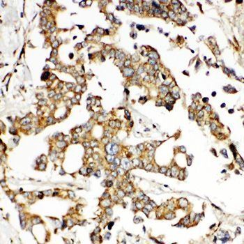 HNF6/ONECUT1 Rabbit Polyclonal Antibody