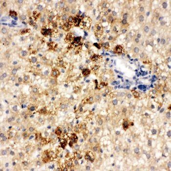 HNF6/ONECUT1 Rabbit Polyclonal Antibody