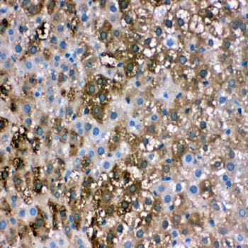 liver FABP/FABP1 Rabbit Polyclonal Antibody