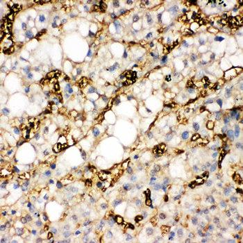 liver FABP/FABP1 Rabbit Polyclonal Antibody