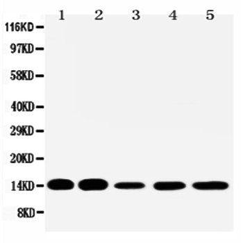 liver FABP/FABP1 Rabbit Polyclonal Antibody