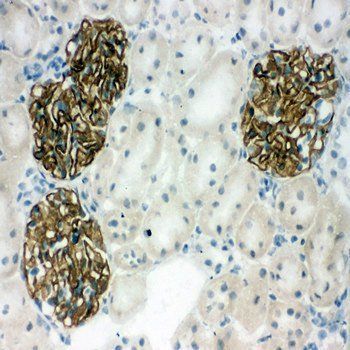 Podocin NPHS2 Rabbit Polyclonal Antibody