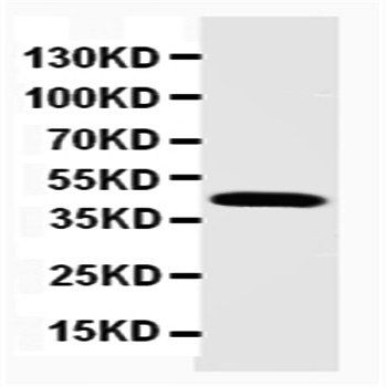 Podocin NPHS2 Rabbit Polyclonal Antibody
