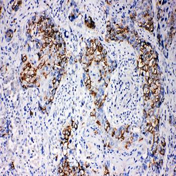 beta Arrestin 1/ARRB1 Rabbit Polyclonal Antibody