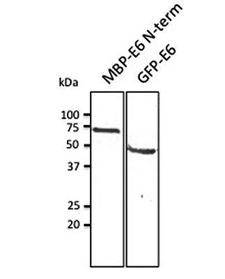HPV11 E6 Antibody