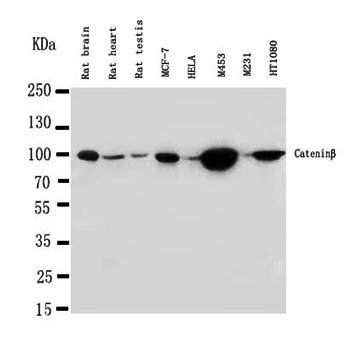 beta Catenin/CTNNB1 Rabbit Polyclonal Antibody