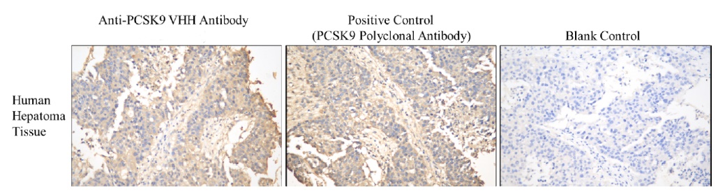 anti-PCSK9 VHH antibody, clone LDL7