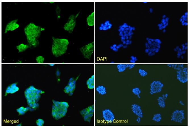 anti-PCSK9 VHH antibody, clone LDL7