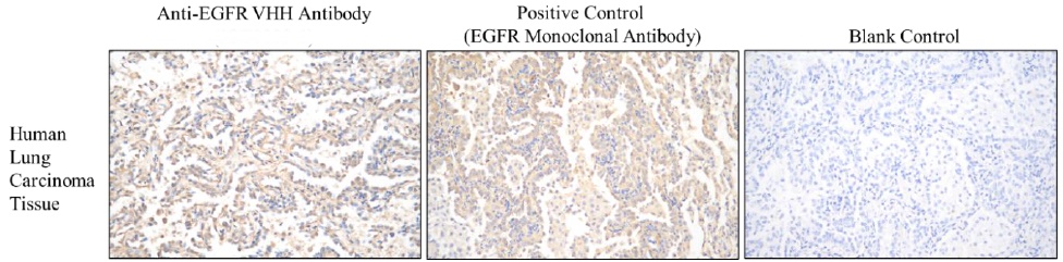 EGFR VHH antibody
