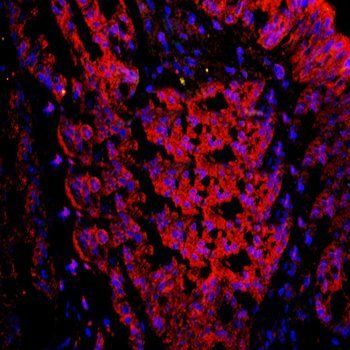 DUOX2 Rabbit Polyclonal Antibody