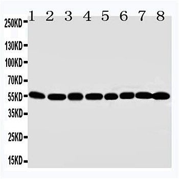 MDM2 Rabbit Polyclonal Antibody