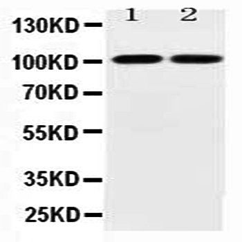 Glutamate receptor 3/GRIA3 Rabbit Polyclonal Antibody