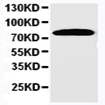 Nicastrin/NCSTN Rabbit Polyclonal Antibody