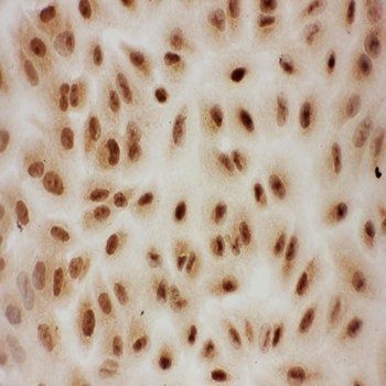 E3 SUMO-protein ligase PIAS1 PIAS1/SUMO Rabbit Polyclonal Antibody