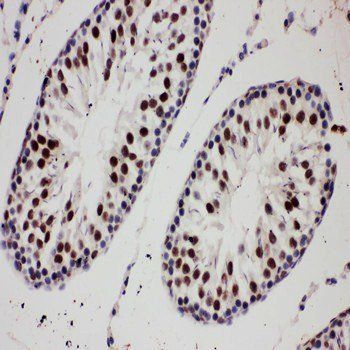 E3 SUMO-protein ligase PIAS1 PIAS1/SUMO Rabbit Polyclonal Antibody