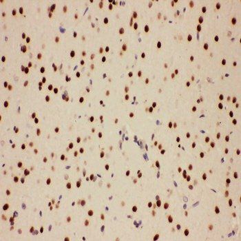 E3 SUMO-protein ligase PIAS1 PIAS1/SUMO Rabbit Polyclonal Antibody