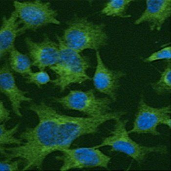 Clathrin HC Antibody