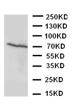 Estrogen Receptor beta/ESR2 Rabbit Polyclonal Antibody