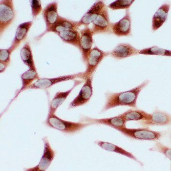 Hsp70/HSPA1A/HSPA1B Rabbit Polyclonal Antibody